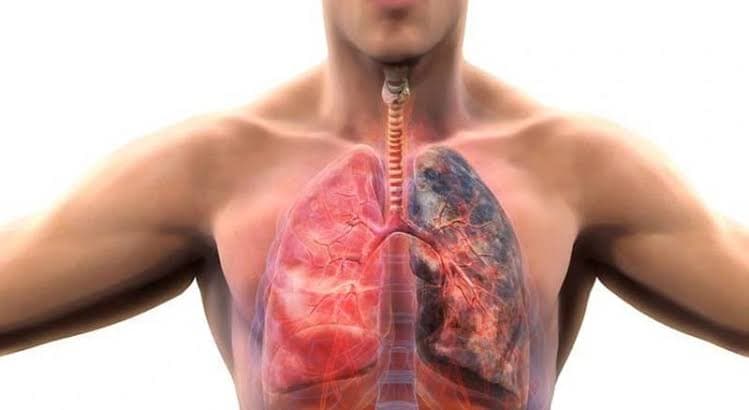 COPD and chronic lung disease
