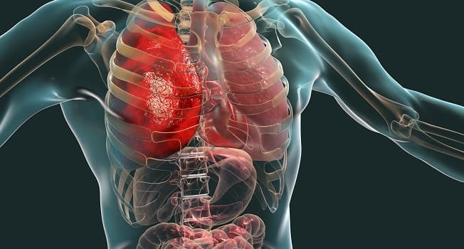 Multi-organ failure critical care