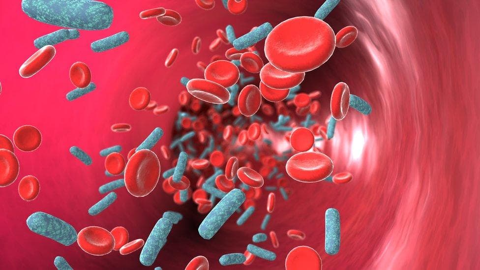 Sepsis and emergency infection care