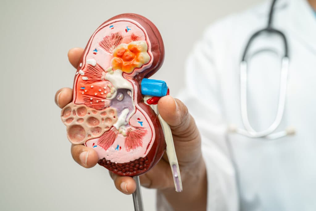 Chronic kidney disease care