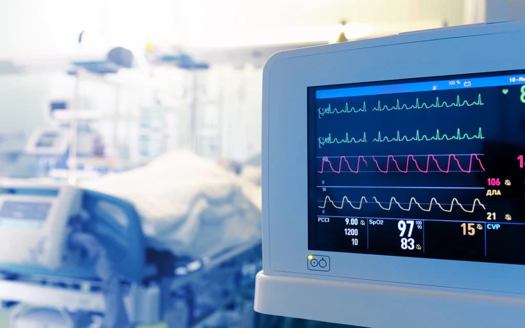 ICU patient monitor displaying vital signs in critical care unit