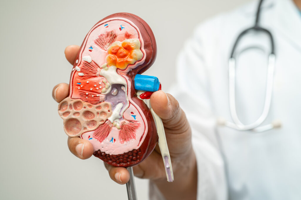 Chronic kidney disease care